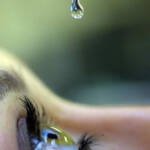 glaucoma olho