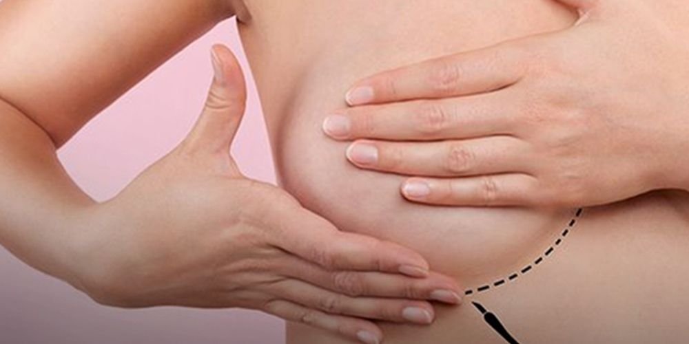Tratamento pode fazer câncer de mama regredir seis vezes mais rápido