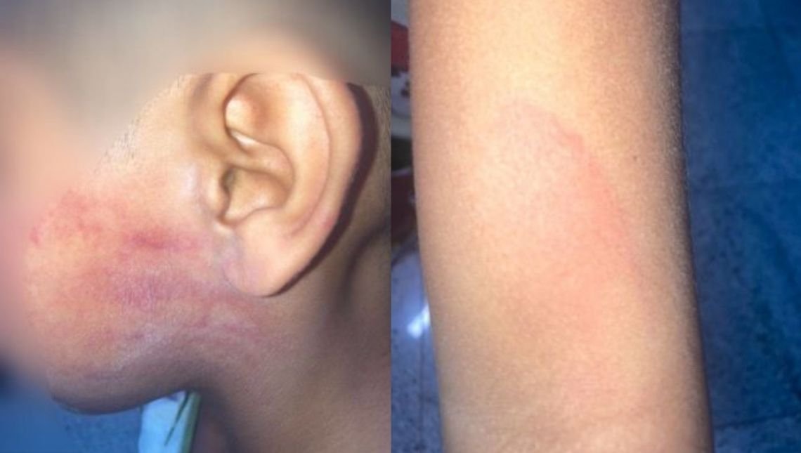Homem é preso suspeito de agredir o filho de seis anos de idade