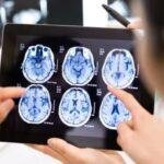 Dèjá vu neurologista alerta que fenômeno nem sempre é inofensivo
