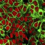 Teste em cobaias revela anticorpo capaz de prevenir disseminação do câncer e retardar evolução de tumor