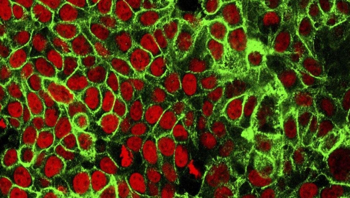 Teste em cobaias revela anticorpo capaz de prevenir disseminação do câncer e retardar evolução de tumor
