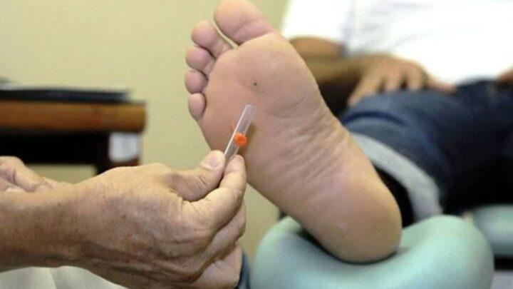 Diabetes: aprenda a identificar a doença pela aparência dos pés
