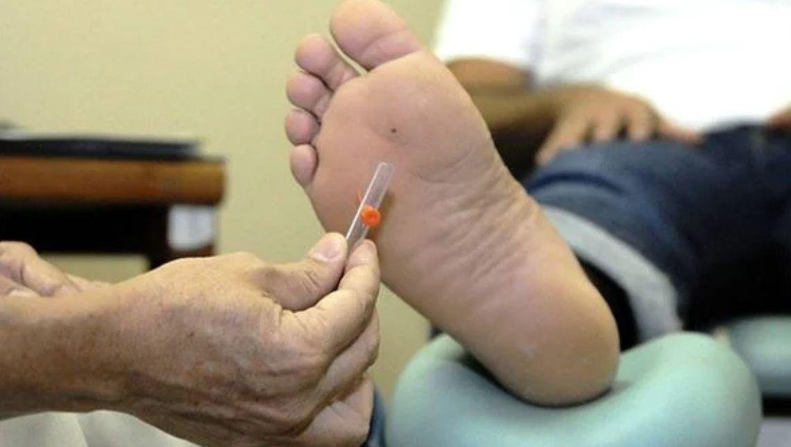 Diabetes aprenda a identificar a doença pela aparência dos pés
