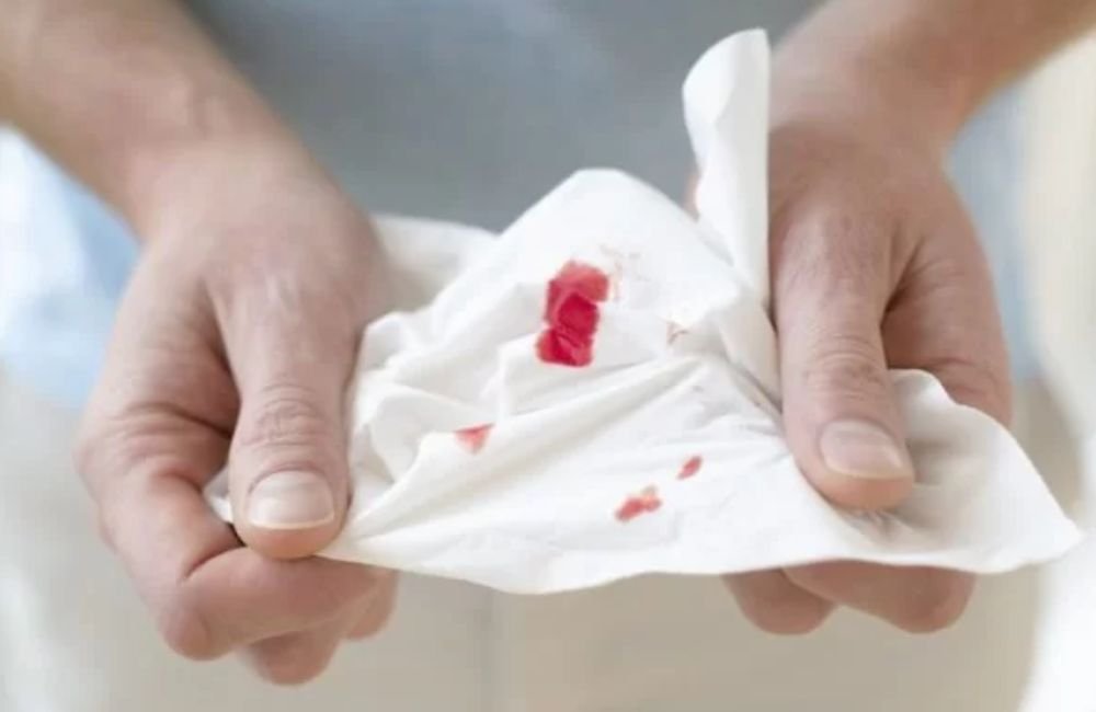 Sangramento nasal: otorrino explica as causas e tratamentos