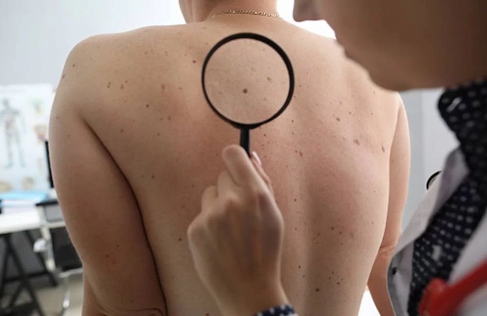 Médico aponta 5 sinais de alerta para câncer em pacientes jovens