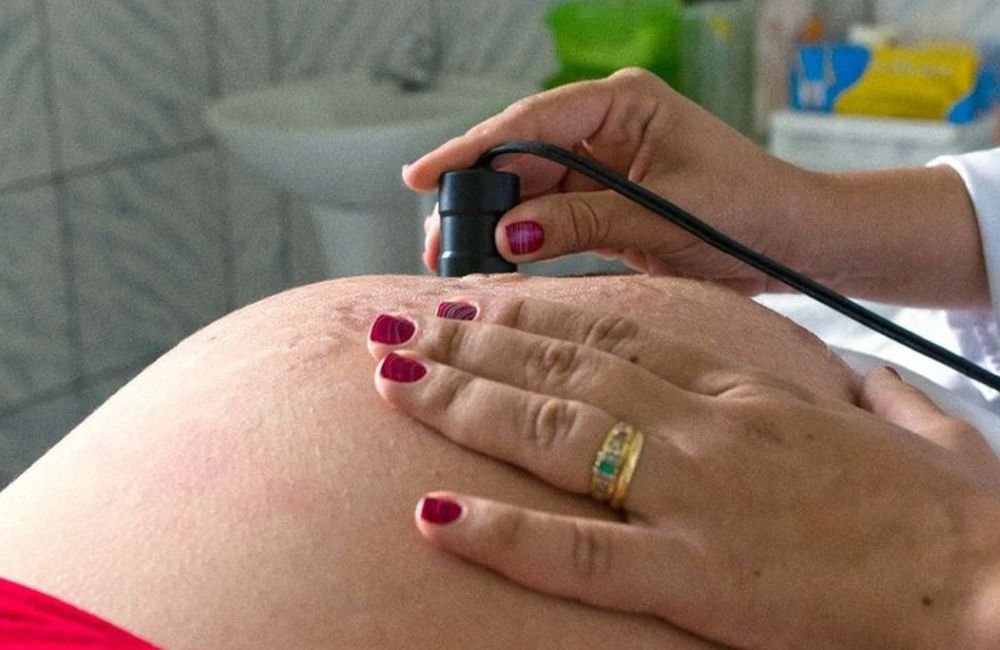 Governo de Goiás quer eliminar transmissão de HIV e sífilis em 14 municípios do estado