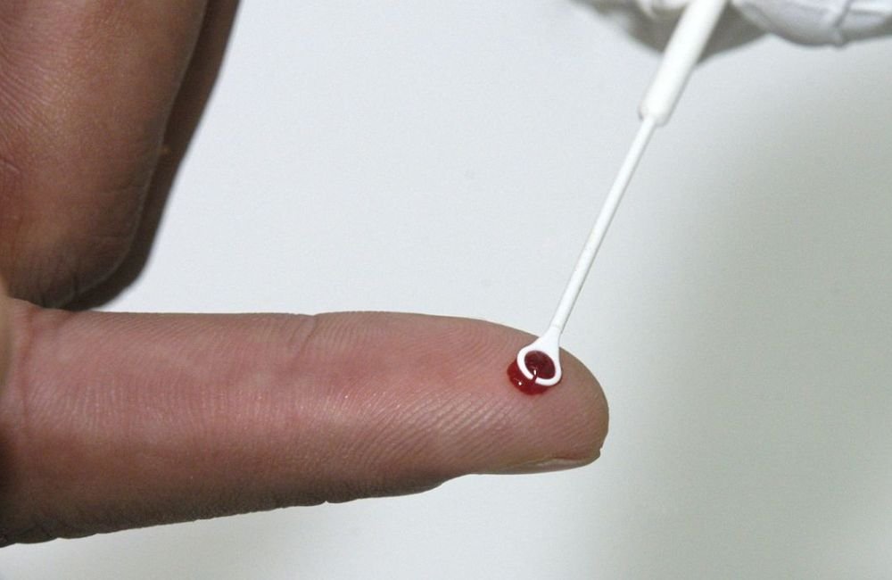 Casos de sífilis e de HIV/aids aumentam entre homens jovens