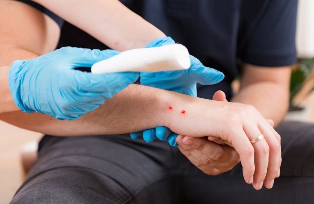 Infectologista orienta sobre picadas e mordidas de animais