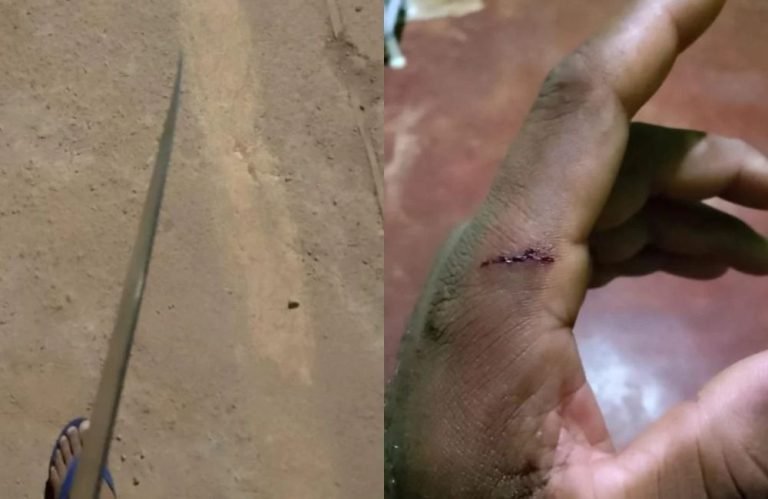 Jovem é golpeado com faca de 20 cm após cair em “emboscada” da ex-companheira