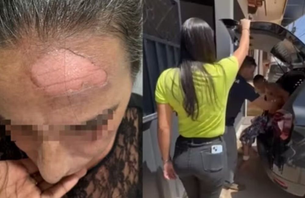 Filho é suspeito de jogar café quente no rosto da mãe por briga de R$ 10, diz polícia