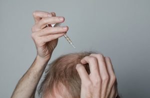 Anvisa determina apreensão de minoxidil sem registro. Veja lista