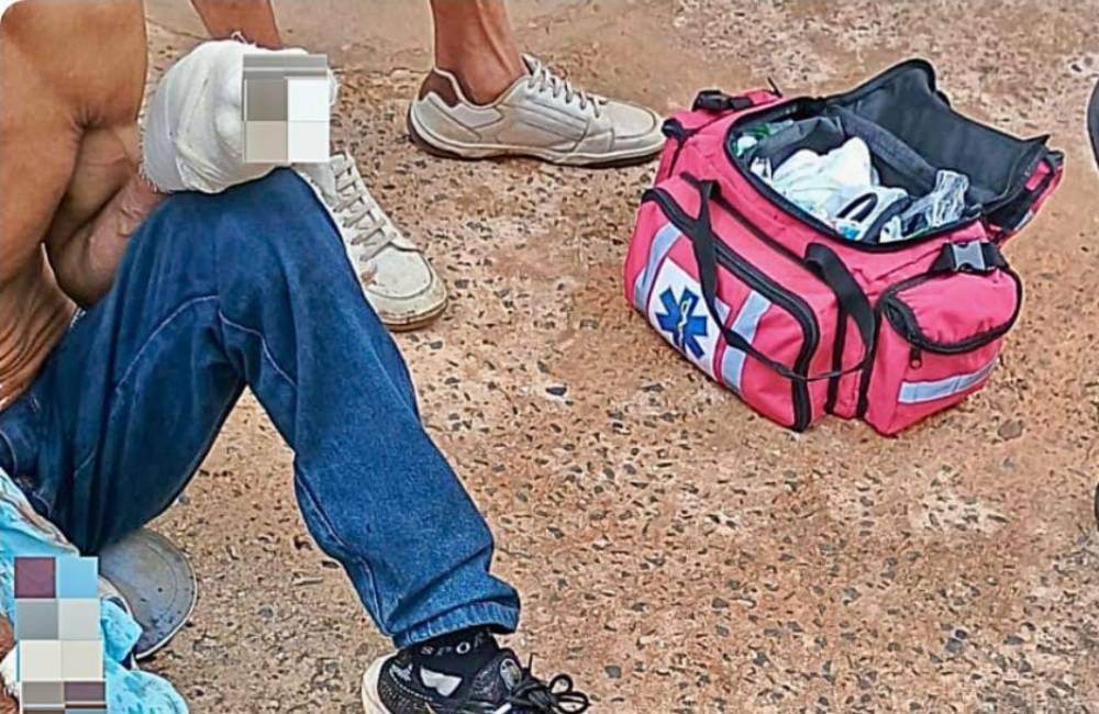 Explosão de bombinha fere homem dentro de comércio em Formosa