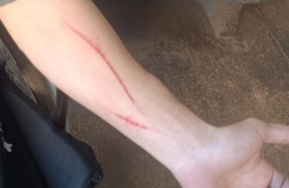 Cadeirante é preso por agredir namorada com tesoura e tráfico de drogas em Rio Verde