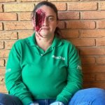 Você saberia como agir diante de um acidente de trabalho como este