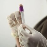 Veja quais tipos sanguíneos têm mais chance de AVC