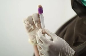 Veja quais tipos sanguíneos têm mais chance de AVC