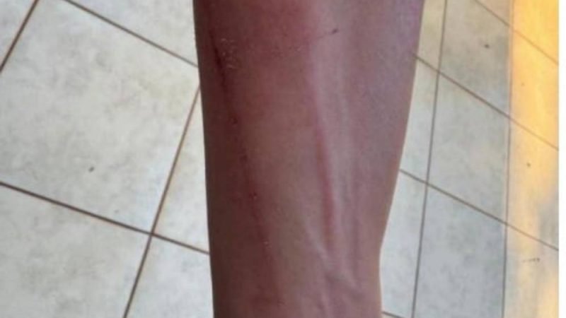 Homem é preso em Jataí por violência doméstica após agredir e ameaçar companheira com faca