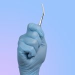 Implante contraceptivo hormonal de longa duração será oferecido no SUS