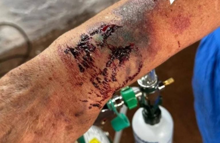 Polícia prende mulher por agredir a própria mãe idosa em Santa Helena de Goiás