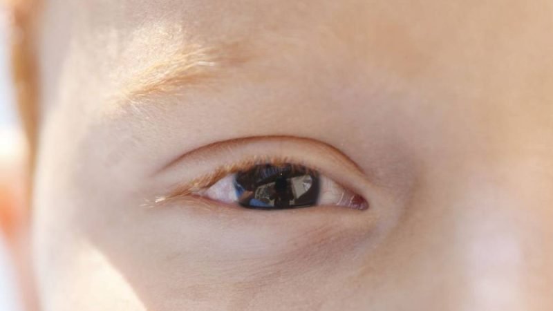 Cartilha sobre saúde ocular na infância orienta pais e professores