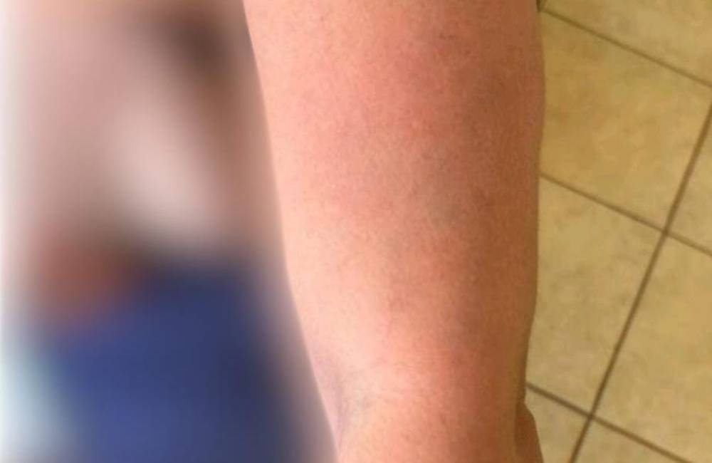 Adolescente agride mãe e causa danos em casa durante briga familiar em Jataí
