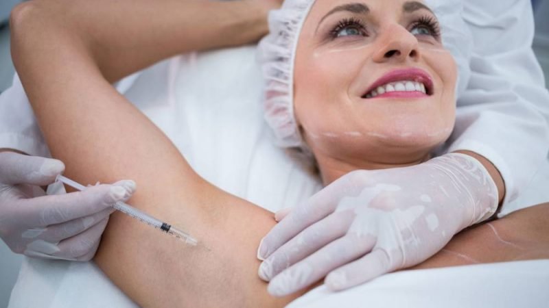 Botox nas axilas surge como alternativa para quem sofre com suor excessivo