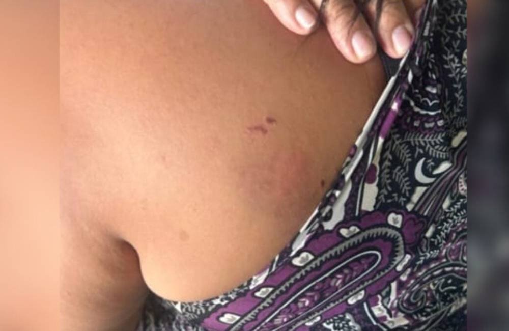 Mulher é agredida pela namorada após surto de ciúmes em Rio Verde