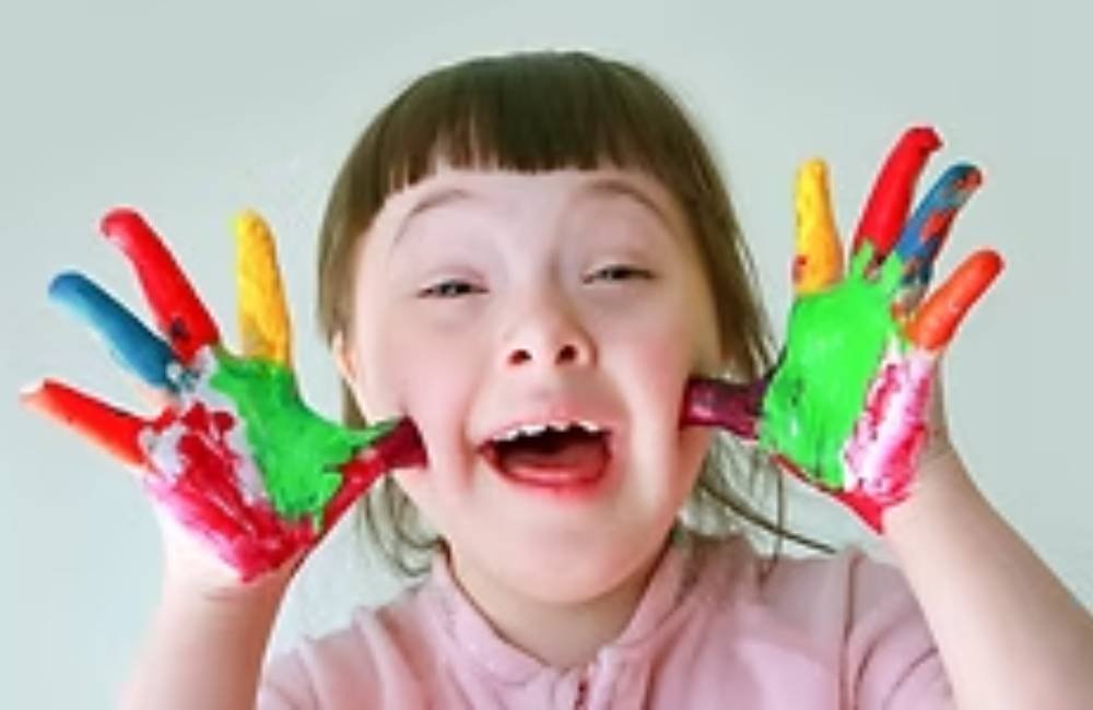 Comissão da Câmara aprova substituição do termo “síndrome de Down” por “Trissomia do Cromossomo 21”