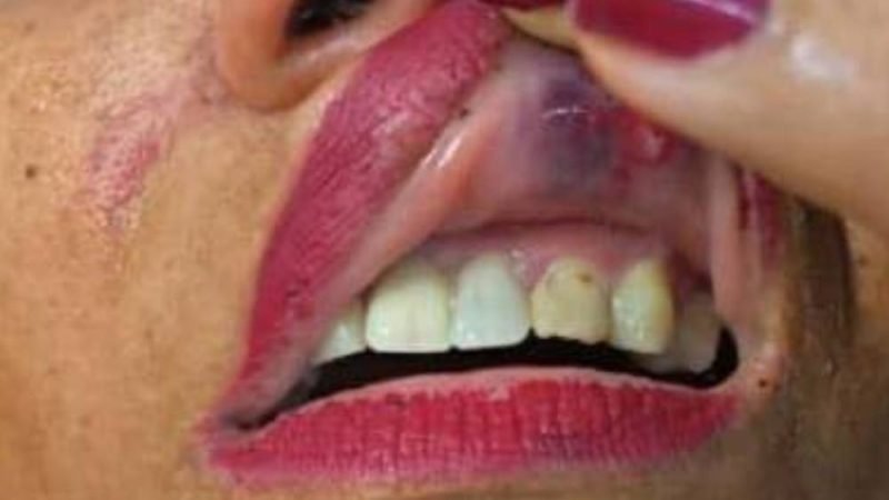 Confusão em rancho: mulher denuncia agressão da atual do ex em Jataí