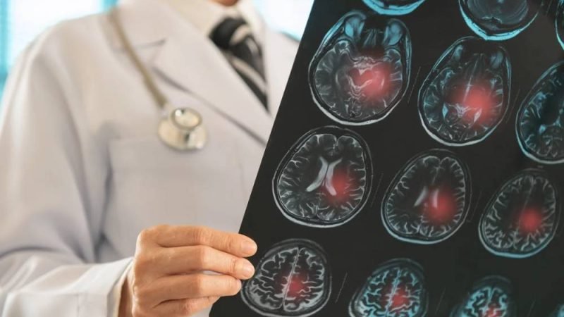 Senado aprova exame nacional para recém-formados em medicina, similar à “OAB da medicina”