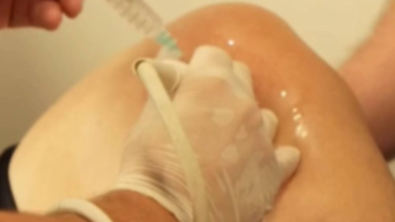 VÍDEO| Rio Verde promove aprimoramento médico e atendimento a pacientes do SUS