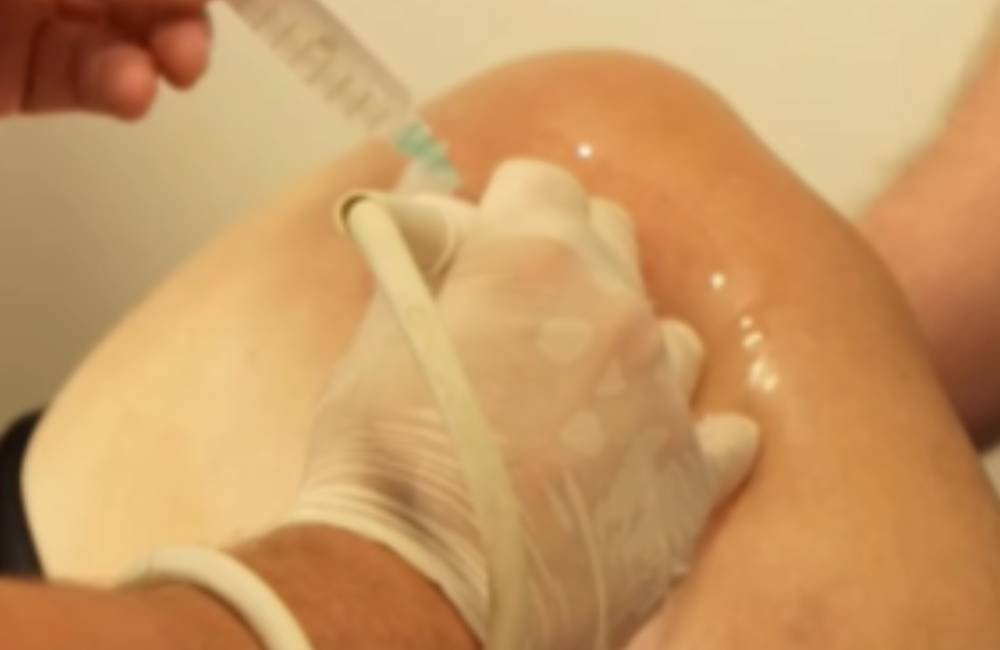 VÍDEO| Rio Verde promove aprimoramento médico e atendimento a pacientes do SUS