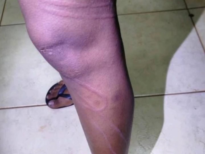 Homem é preso em Jataí suspeito de agredir companheira e resistir à abordagem policial