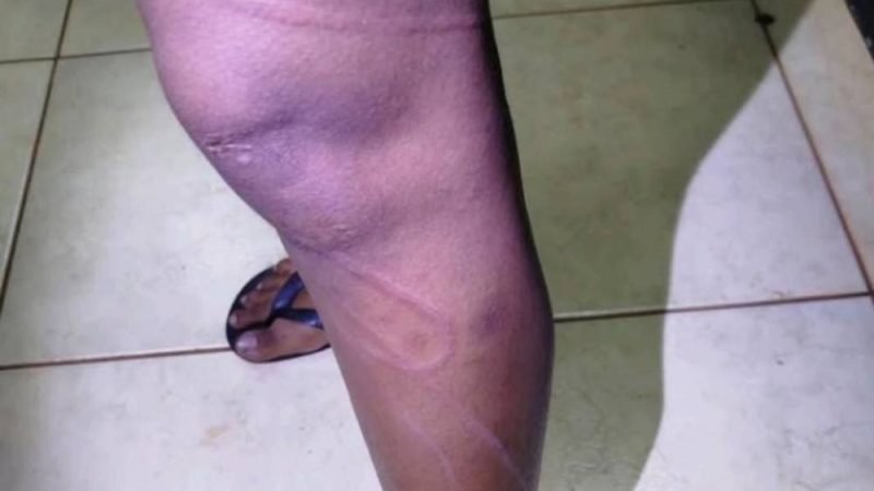 Homem é preso em Jataí suspeito de agredir companheira e resistir à abordagem policial