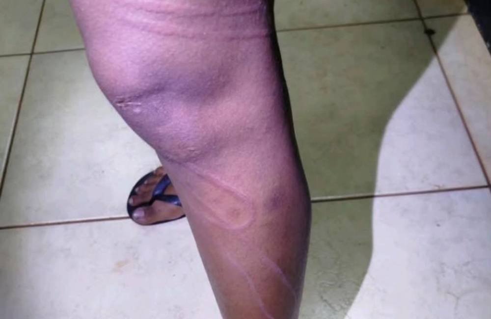 Homem é preso em Jataí suspeito de agredir companheira e resistir à abordagem policial