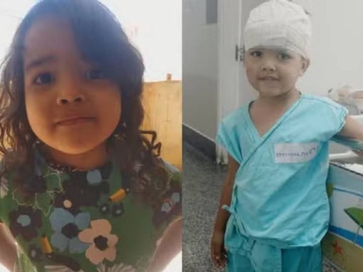 Menina de Jataí é hospitalizada após ser atacada por pit bull dentro de casa