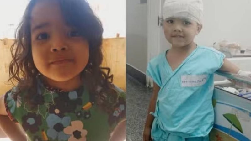Menina de Jataí é hospitalizada após ser atacada por pit bull dentro de casa