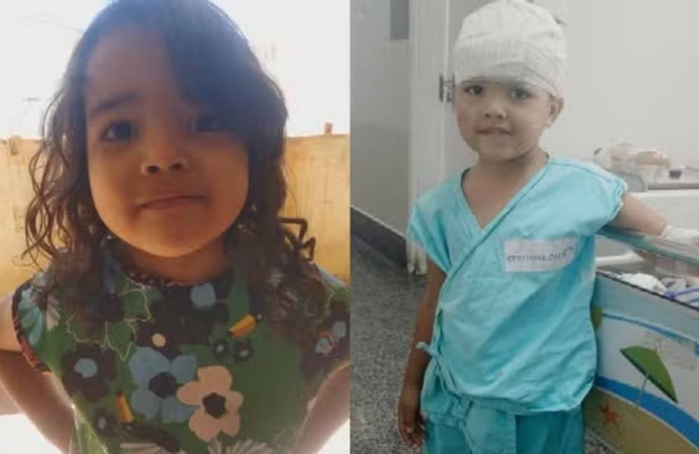 Menina de Jataí é hospitalizada após ser atacada por pit bull dentro de casa
