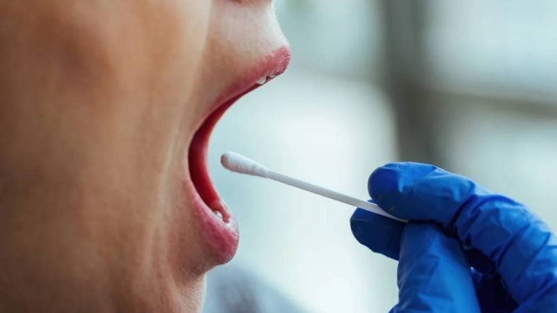 Teste de saliva pode ajudar a identificar sinal associado ao câncer colorretal
