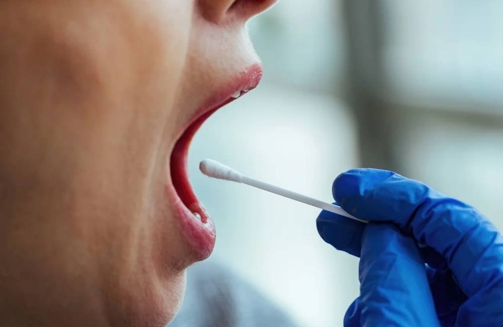 Teste de saliva pode ajudar a identificar sinal associado ao câncer colorretal