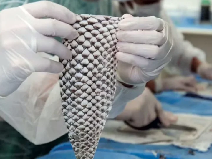 Brasil terá fábrica de curativos feitos com pele de tilápia para tratar queimaduras