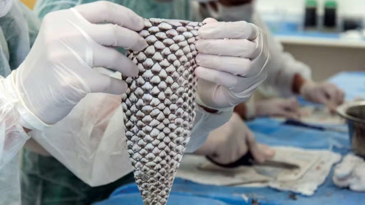 Brasil terá fábrica de curativos feitos com pele de tilápia para tratar queimaduras